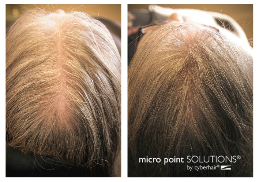 micropoint links before and after