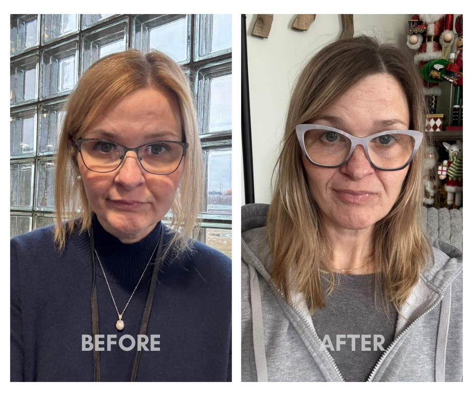 From thin to brittle hair to full and healthy hair
