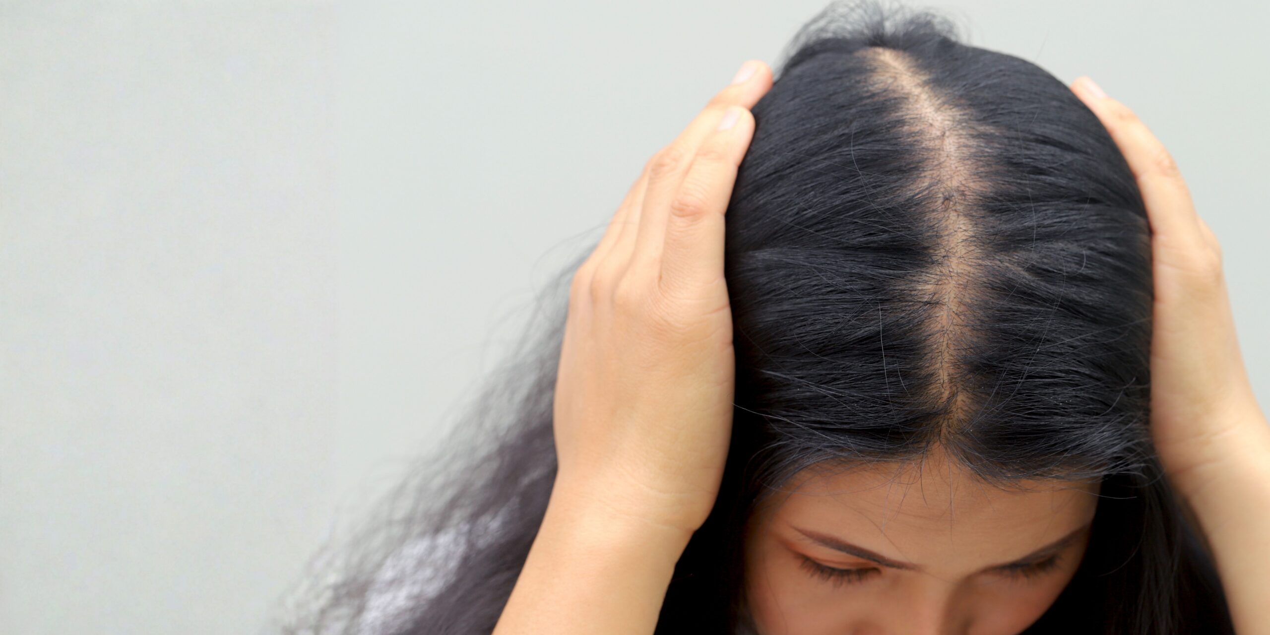 Woman hold hair down and can see and expanding part line